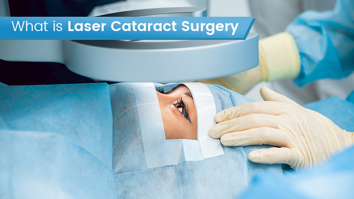 Laser Cataract Surgery - DLEI