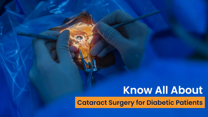 Know All About Cataract Surgery For Diabetic Patients